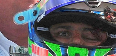 Massa.jpg