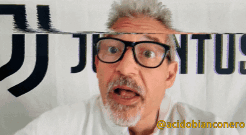 zuliani-acidobianconero.gif